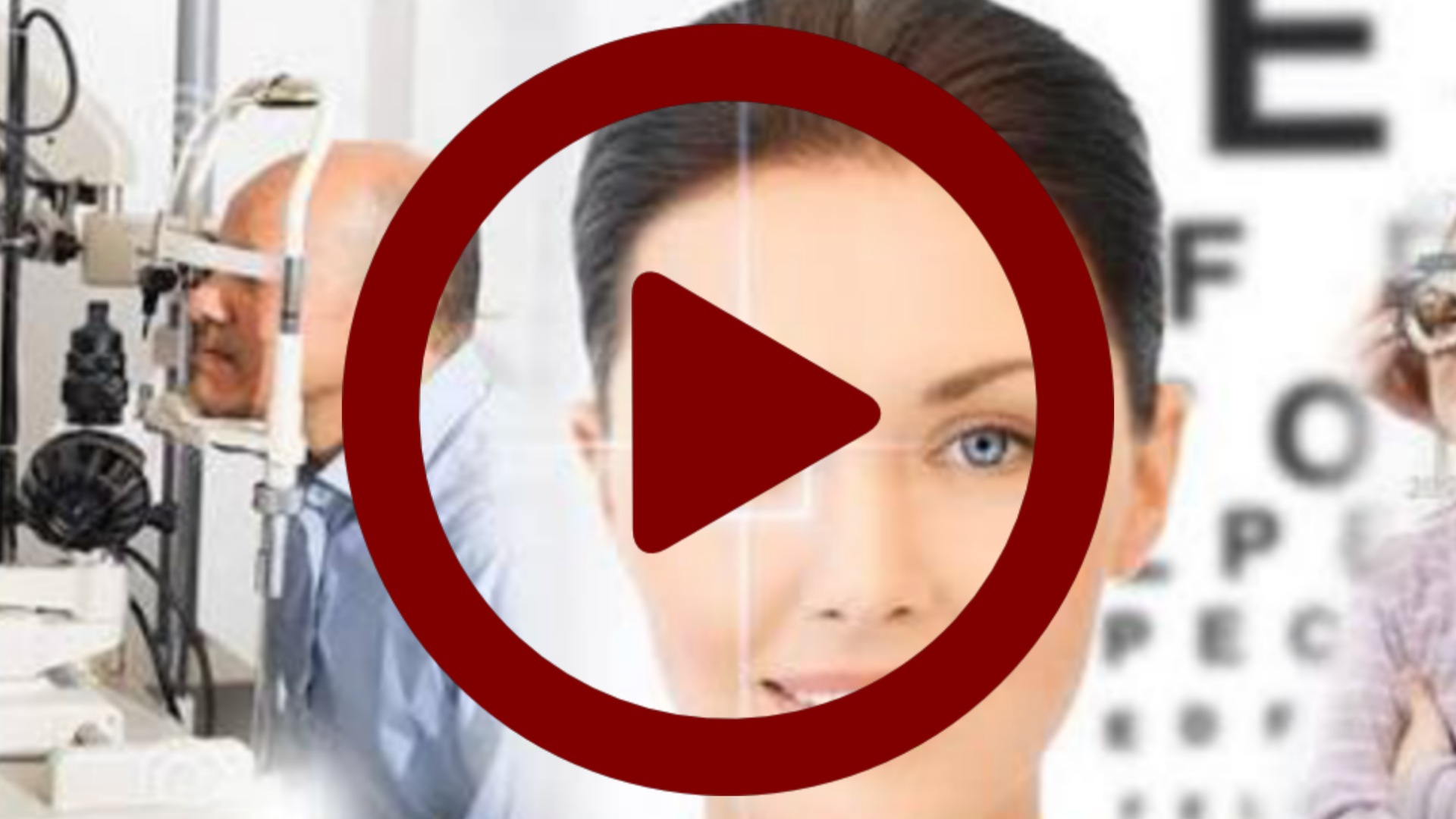 ویدیو عمل لیزیک | لنز مد